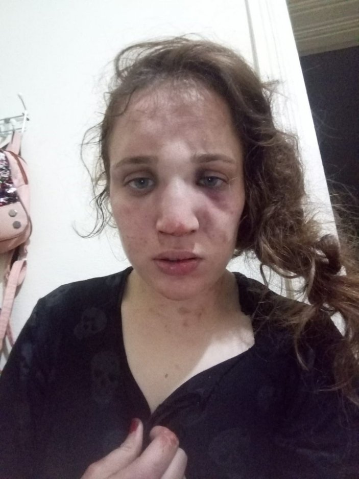 Aydın'da kocasından şiddet gören genç kadın yardım istiyor