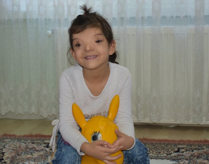 Malatya'da minik Ayşenur, gözlerindeki rahatsızlık için yardım bekliyor