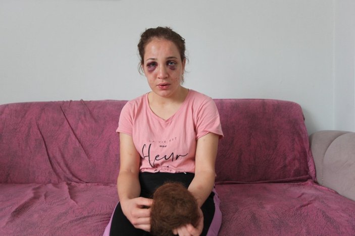 Aydın'da eşini döven kişiye 60 gün uzaklaştırma verildi