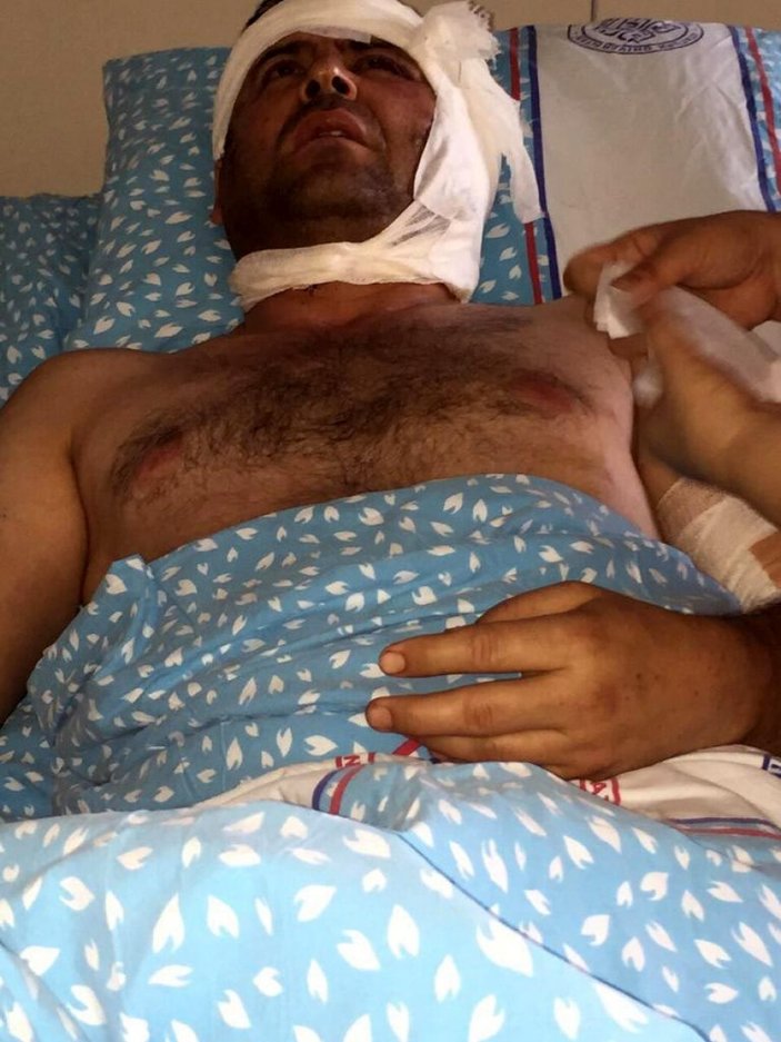 Ağrı'da terörist saldırısında yaralanan gazi tazminattan vazgeçti