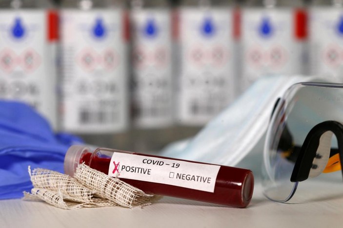 Bilim insanları, bazı kan gruplarının koronavirüse karşı daha dirençli olduğunu tespit etti