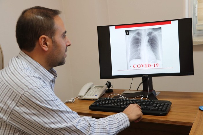 Van'da röntgen filmlerinden koronavirüsü teşhis eden sistem geliştirdi