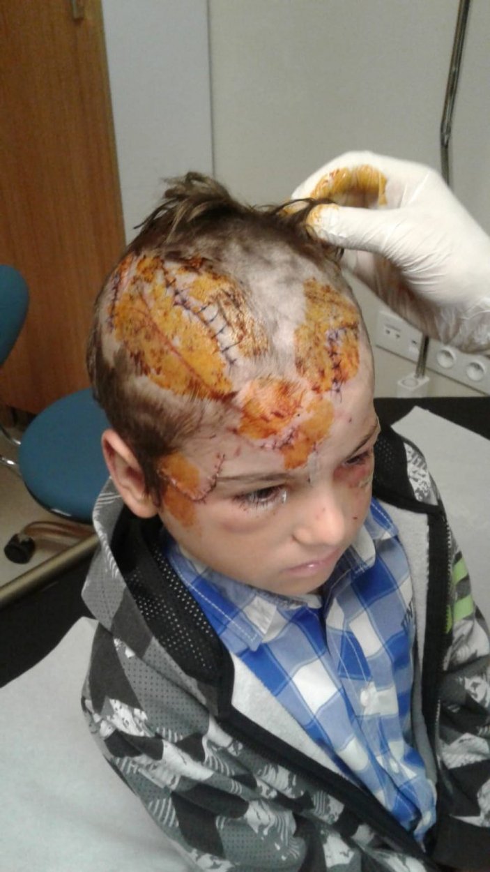 Kocaeli'de 8 yaşındaki çocuğa kangal saldırdı