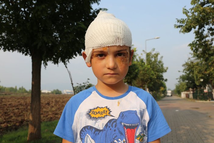 Kocaeli'de 8 yaşındaki çocuğa kangal saldırdı