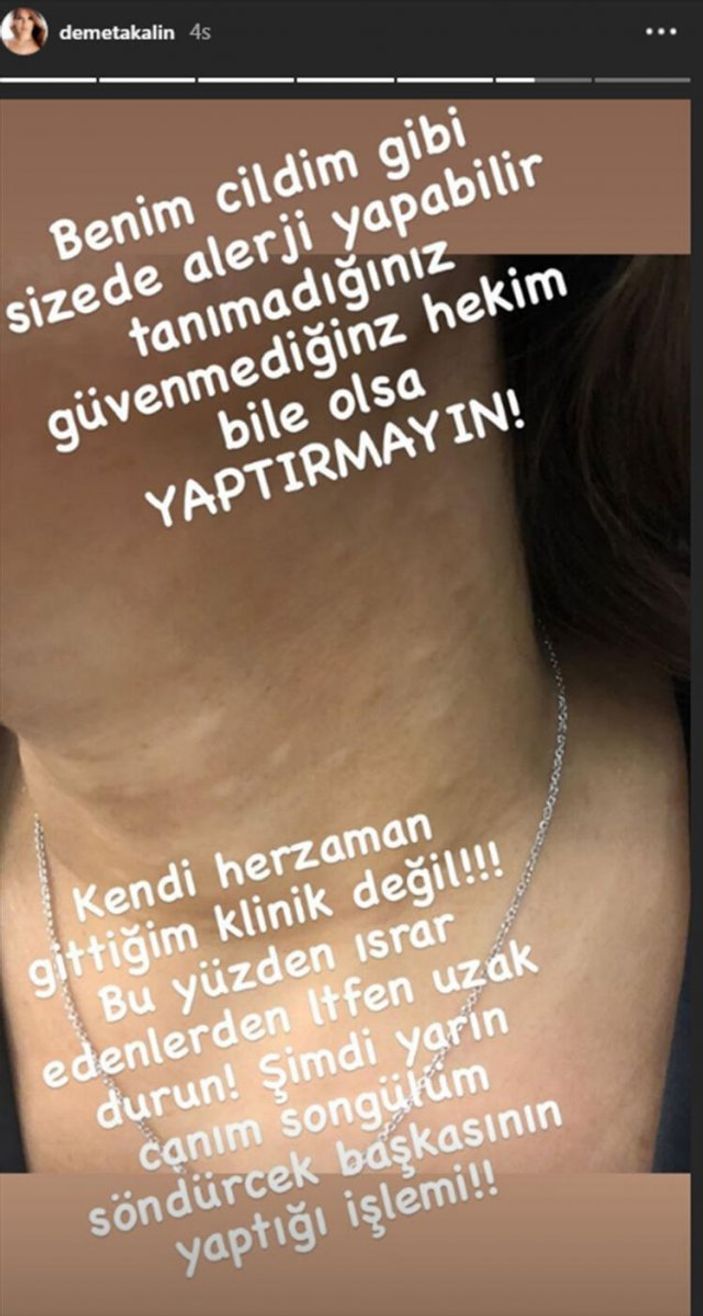 Demet Akalın'ın gençlik aşısı pişmanlığı