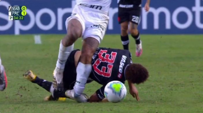 Felipe Melo ameliyat edilecek