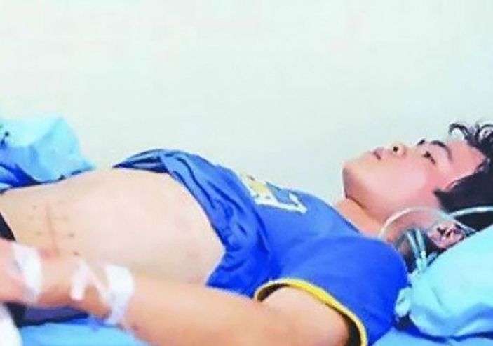 Çin'de iPhone almak için böbreğini sattı, yatalak kaldı