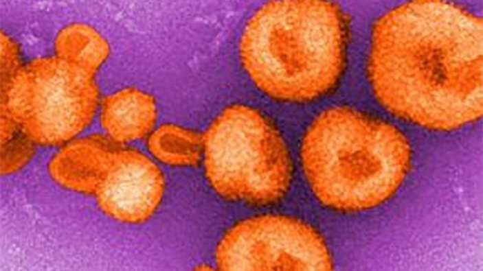 Chapare virüsü nedir, nasıl bulaşır? Bolivya'da görülen Chapare virüsü belirtileri nelerdir?