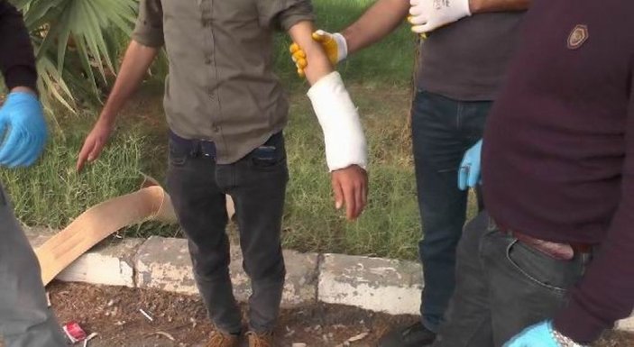Mardin'de teröristin kolundaki alçıdan bomba çıktı