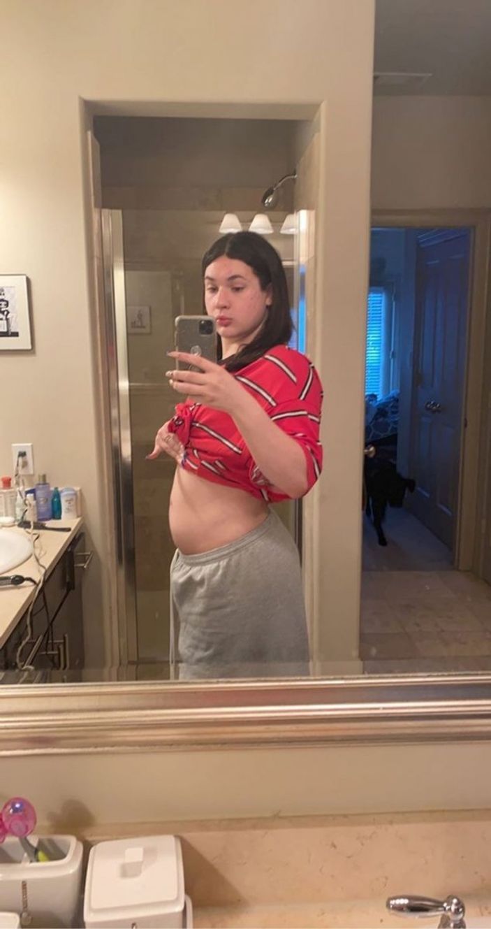 ABD'de kadın üreme organlarıyla erkek olarak doğdu, hamile kaldı