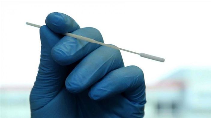 a Koronavirüs test ücretleri nasıl geri alınır? Ücret iadesi için yapılması gerekenler...