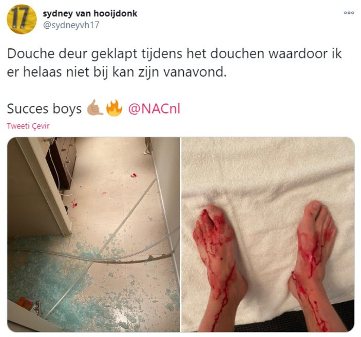 Sydney van Hooijdonk duşta mahsur kalınca ayaklarını parçaladı