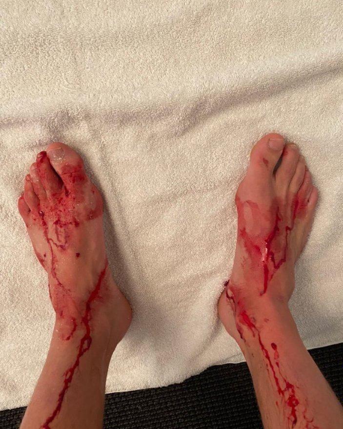 Sydney van Hooijdonk duşta mahsur kalınca ayaklarını parçaladı