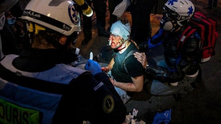 Fransa'da gazeteciye polis şiddeti