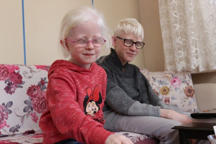 Konya'da Albinizm hastası Hüseyin Ali, azmiyle kendisi gibi çocuklara cesaret veriyor