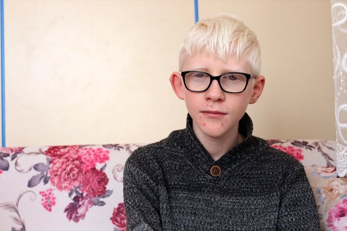 Konya'da Albinizm hastası Hüseyin Ali, azmiyle kendisi gibi çocuklara cesaret veriyor