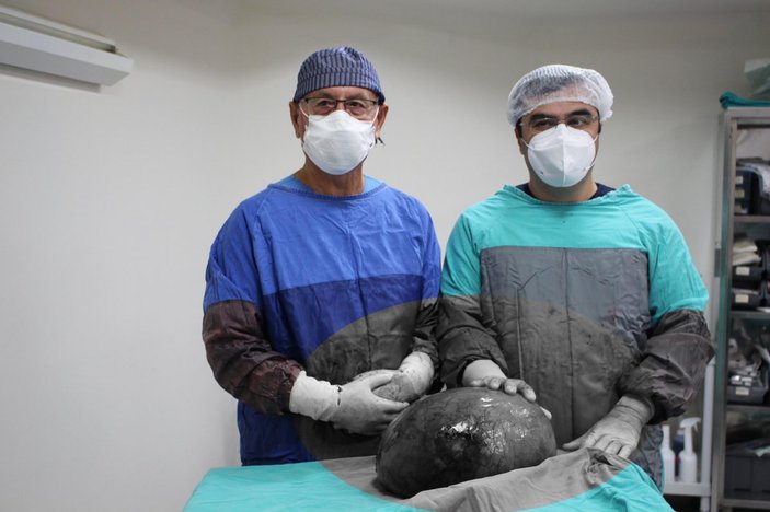 Eskişehir'de karnından üç bebek büyüklüğünde tümör çıkarıldı