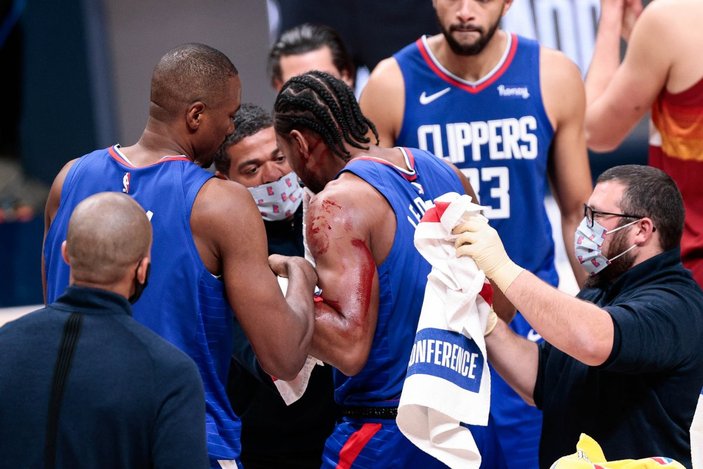 Kawhi Leonard kanlar içinde kaldı