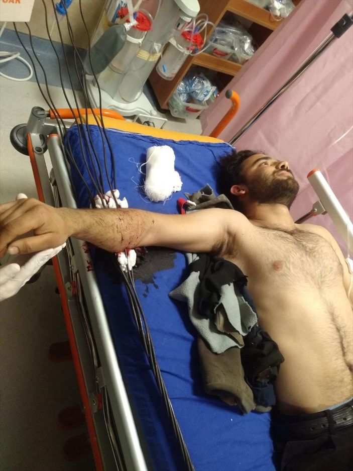 a Sivas'ta YHT inşaatında koluna çelik tel saplanan işçi yaralandı