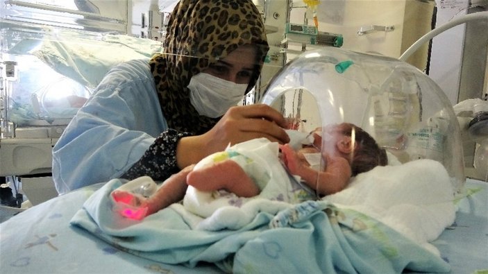 Tokat'ta tek ayaklı doğan prematüre bebek, yaşama tutundu