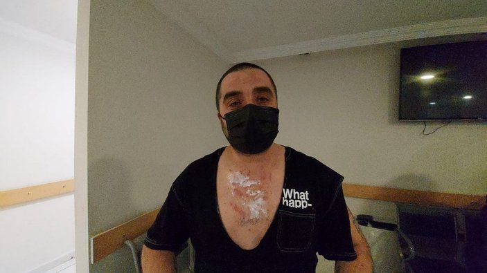 Zonguldak'ta sobaya benzin döktü, ağır yaralandı
