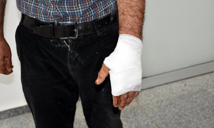 Aksaray'da torunlarını korumak isteyen dedeye sokak köpeği saldırdı