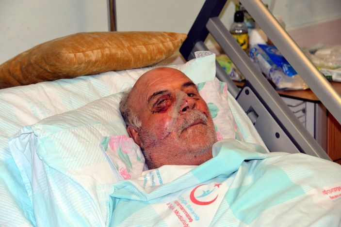 d Kahramanmaraş'ta spiral makinesiyle demir keserken yüzü parçalandı