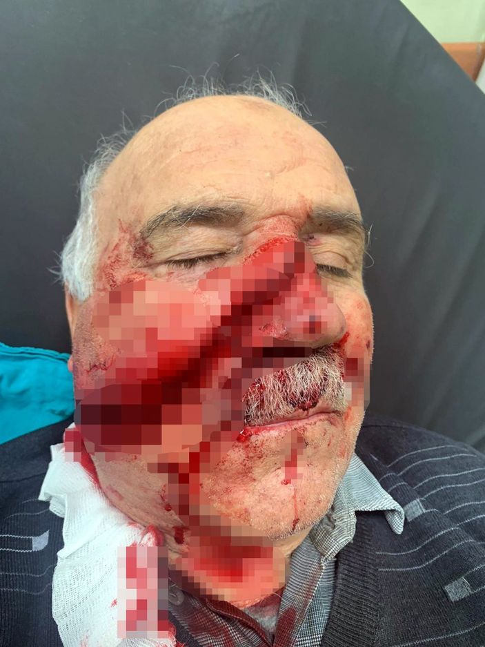 d Kahramanmaraş'ta spiral makinesiyle demir keserken yüzü parçalandı