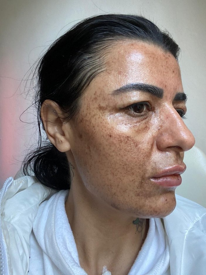 Antalya'da güzellik salonuna giden kadın hayatının şokunu yaşadı