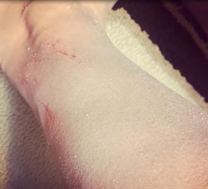 Esra Dermancıoğlu hastalığını açıkladı