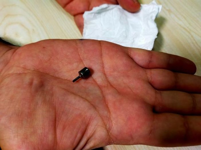 Bursa'da dişçiye giden kadın implant parçasını yuttu