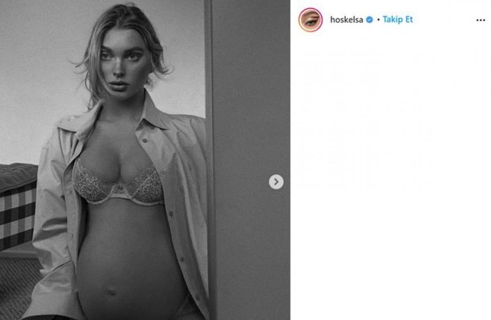 Elsa Hosk doğumu anlattı