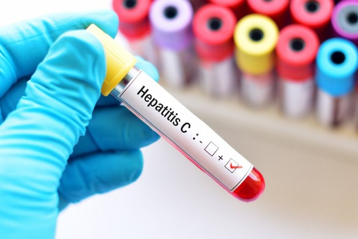 Hepatit C enfeksiyonundan korunmanın 5 Yolu