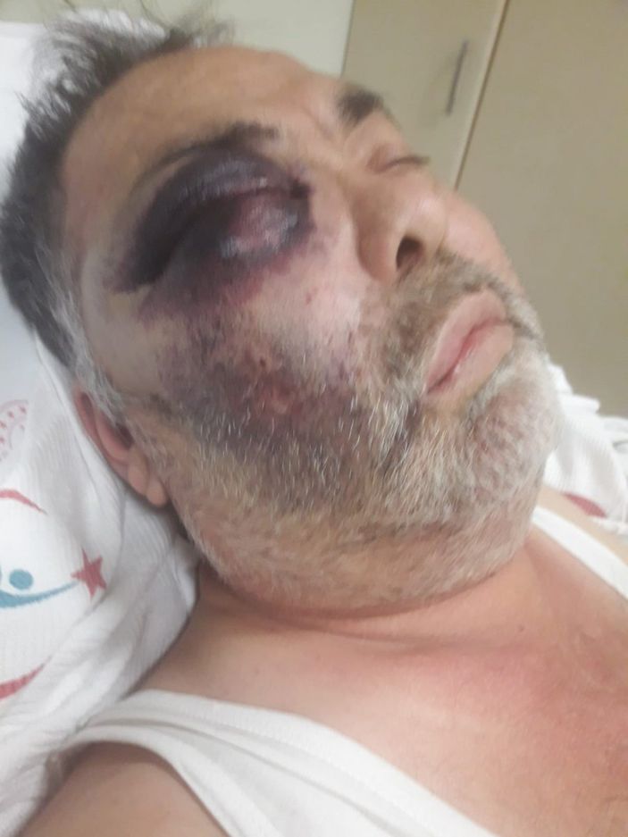 Antalya'da yüzde 90 engelli adamı öldüresiye darbettiler