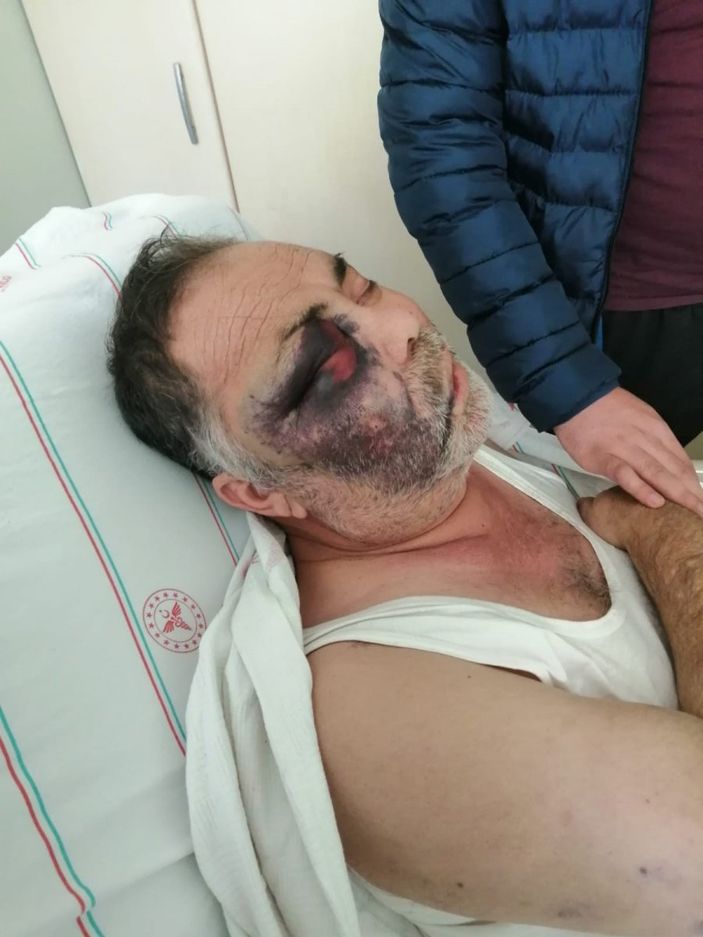 Antalya'da yüzde 90 engelli adamı öldüresiye darbettiler