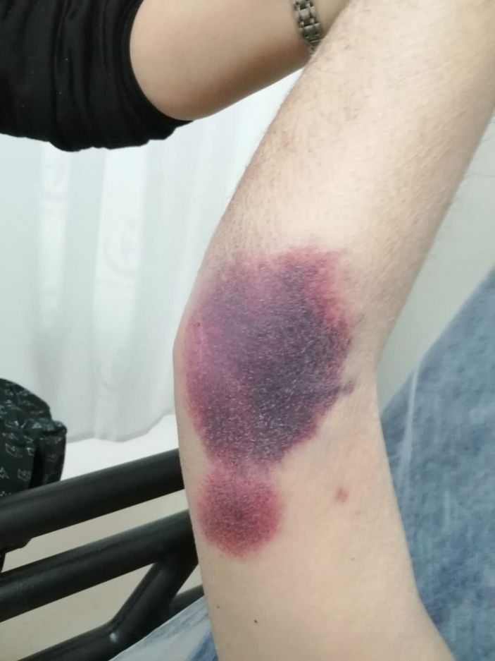 Antalya'da engelli kişiyi darbeden şahıs tutuklandı