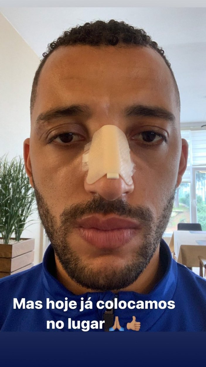 Vitor Hugo'nun burnunda kırık tespit edildi