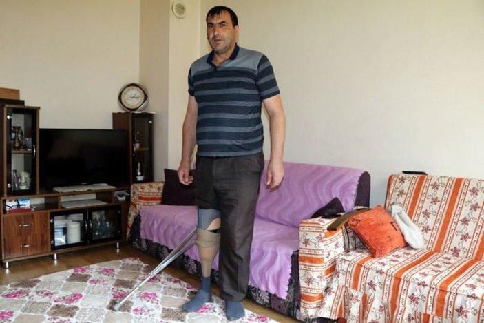 Çankırı'da sigaradan bacağını kaybeden Buerger hastası Yaman, yaşadıklarını anlattı