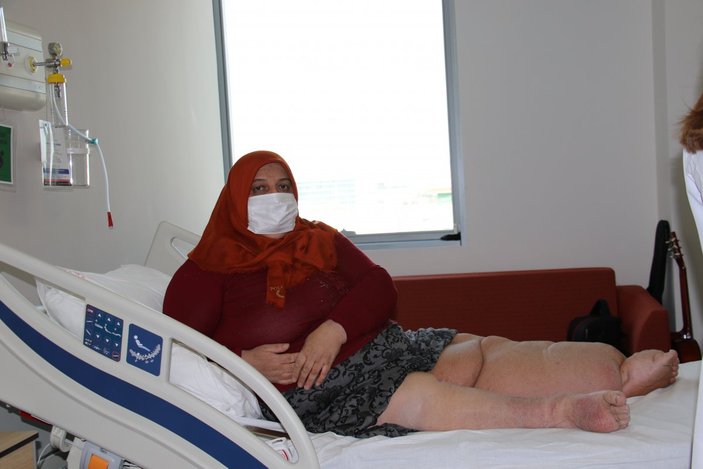 Bursa'daki fil hastası kadın, artık yürüyebiliyor
