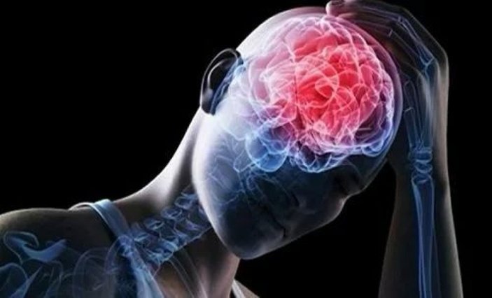 Beyin embolisi nedir, belirtileri nelerdir? Emboliden korunmak için ne yapmalı, tedavisi var mı?