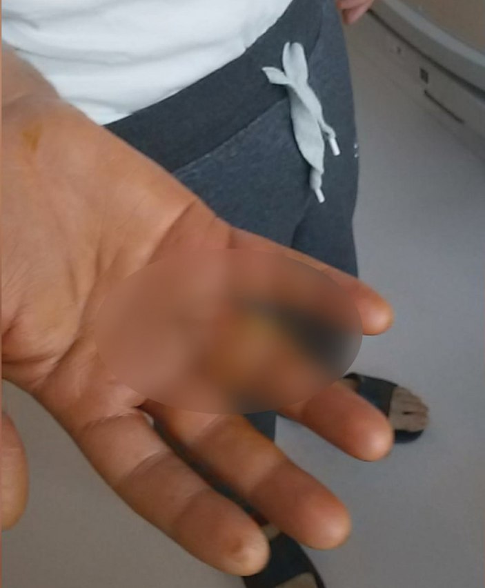 Nişantaşı'nda garsonun eline batan kürdan kabusu oldu