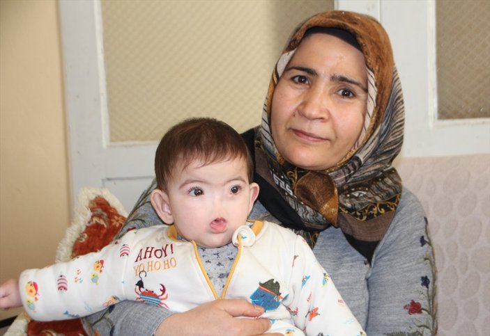 Antalyalı aile, burnu olmadan dünyaya gelen çocukları için destek bekliyor