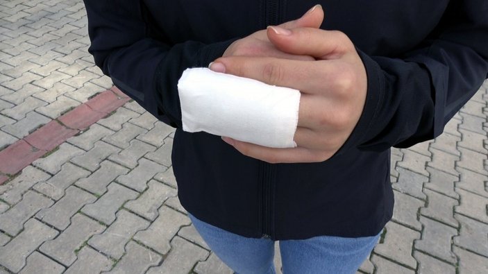 Samsun'da parmakları ısırılan sağlıkçı: Telafisi asla olmayacak