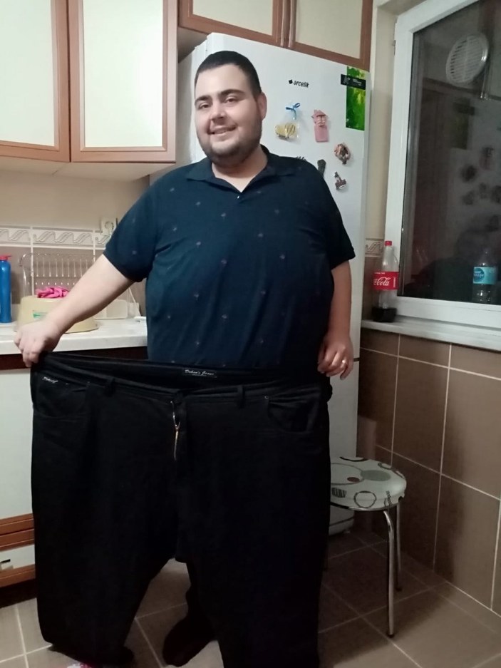 Ankaralı esnaf, mide küçültme ameliyatı ile 129 kilo verdi