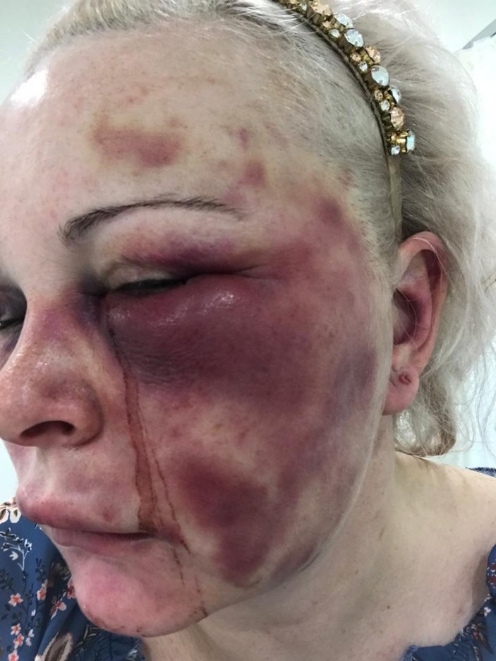 Ataşehir’de Rus kadına otel odasında günlerce işkence edildi