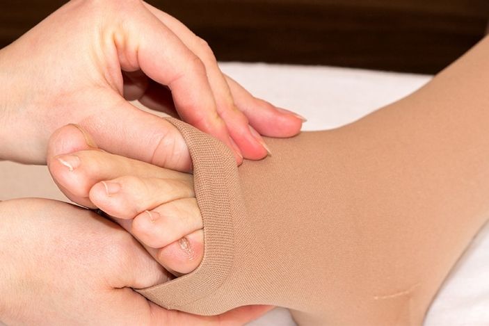 Lenfödem belirtileri ve tedavi yöntemleri