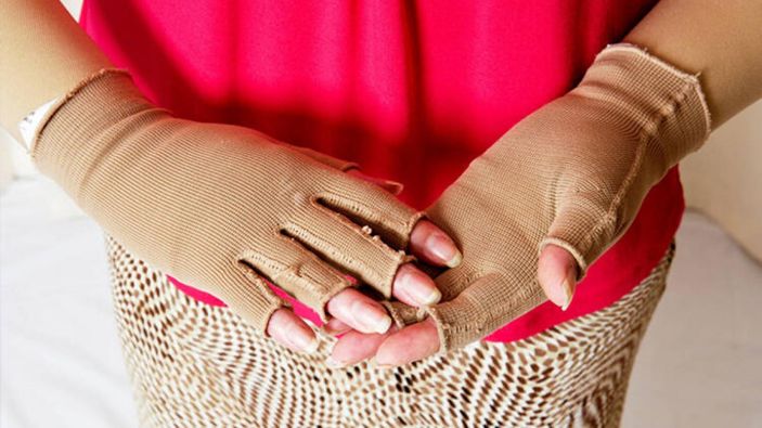 Lenfödem belirtileri ve tedavi yöntemleri