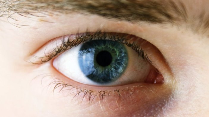 Sarı nokta hastalığı kalıcı görme kayıplarına yol açabilir