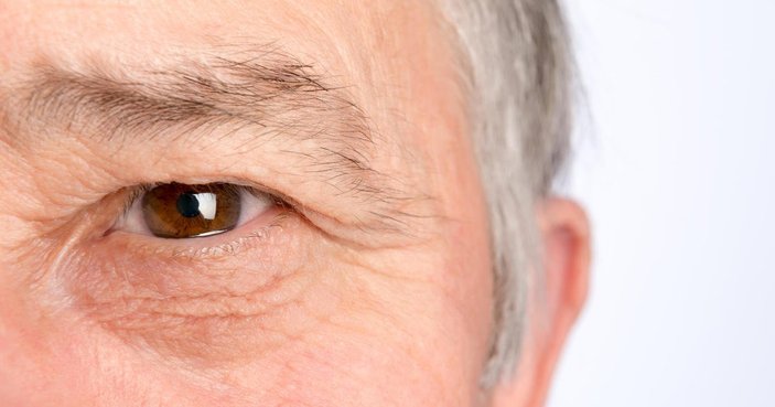 Sarı nokta hastalığı kalıcı görme kayıplarına yol açabilir