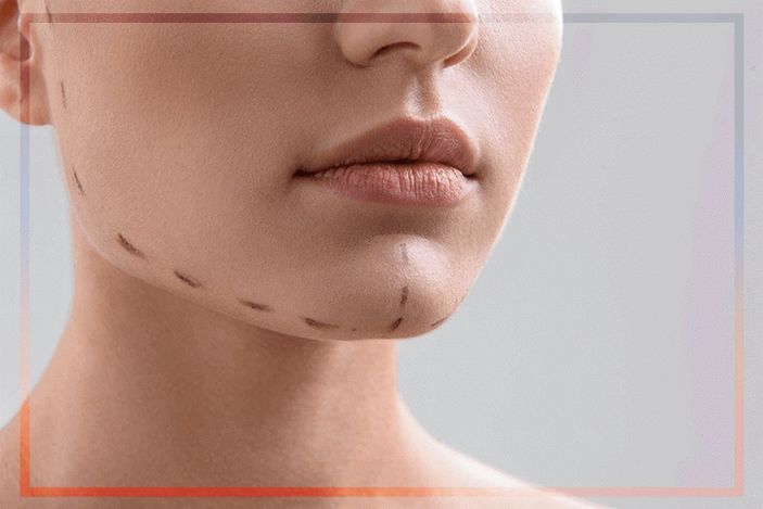 Çene Hattını Yeniden Biçimlendiren Uygulamalar; Botoks ve Jawline Dolgusu